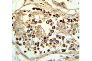 IHC analysis of FFPE human testis tissue stained with ABHD12 antibody