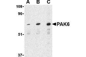 Western Blotting (WB) image for anti-P21-Activated Kinase 6 (PAK6) (Middle Region) antibody (ABIN1031032)