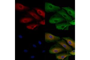 ABIN7093965 and ABIN7098009 staining  cells by IF/ICC. (PSPH 抗体  (Internal Region))