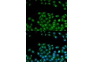 Immunofluorescence analysis of HeLa cells using SFRP2 antibody (ABIN5973117). (SFRP2 抗体)