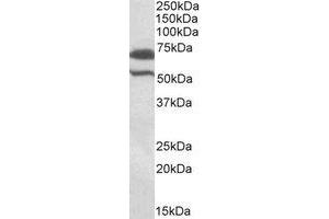 Western Blotting (WB) image for anti-Baculoviral IAP Repeat Containing 3 (BIRC3) (Internal Region) antibody (ABIN2464738) (BIRC3 抗体  (Internal Region))
