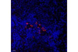 Immunofluorescence of paraffin embedded rat spleen using CNG1 (ABIN7073608) at dilution of 1:700 (400x lens) (CNGA1 抗体)