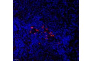 Immunofluorescence of paraffin embedded rat spleen using CNG1 (ABIN7073608) at dilution of 1:700 (400x lens)