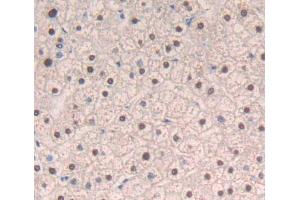 Used in DAB staining on fromalin fixed paraffin- embedded liver tissue (DIDO1 抗体  (AA 258-455))