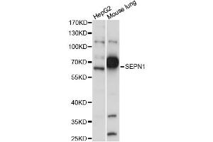 Western blot analysis of extracts of various cell lines, using SEPN1 antibody (ABIN6289941) at 1:1000 dilution. (Selenoprotein N 抗体)