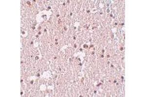 Immunohistochemistry of FRMPD3 in human brain tissue with FRMPD3 antibody at 5 μg/ml. (FRMPD3 抗体  (Center))