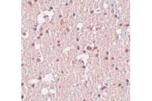 Immunohistochemistry of FRMPD3 in human brain tissue with FRMPD3 antibody at 5 μg/ml. (FRMPD3 抗体  (Center))