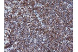 Immunohistochemistry (IHC) image for anti-T-cell surface glycoprotein CD1c (CD1C) antibody (ABIN1497187) (CD1c 抗体)