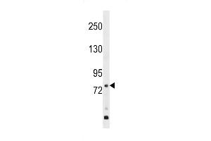 Western blot analysis in WiDr cell line lysates (35ug/lane). (GPR149 抗体  (AA 421-449))