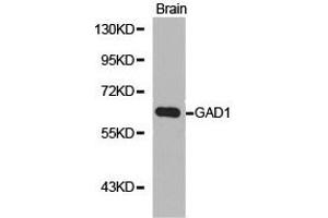Western Blotting (WB) image for anti-Glutamate Decarboxylase 1 (Brain, 67kDa) (GAD1) antibody (ABIN1872765) (GAD 抗体)