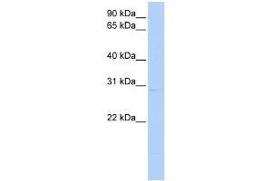 WB Suggested Anti-KCNIP2 Antibody Titration:  0.