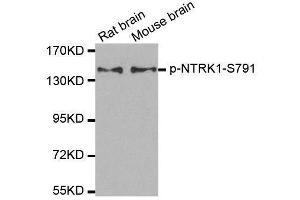 Western blot analysis of extracts from rat and mouse brain tissue using Phospho-NTRK1-S791 antibody (ABIN2987788). (TRKA 抗体  (pSer791))