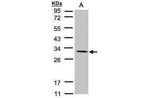 Western Blotting (WB) image for anti-NADH Dehydrogenase (Ubiquinone) Flavoprotein 2, 24kDa (NDUFV2) (Center) antibody (ABIN2855340)