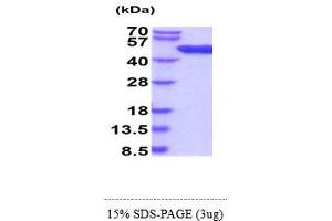 ADK Protein (AA 1-361) (His tag)