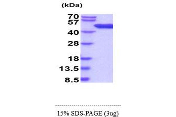 ADK Protein (AA 1-361) (His tag)