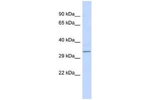 WB Suggested Anti-RFPL4B Antibody Titration:  0. (RFPL4B 抗体  (Middle Region))