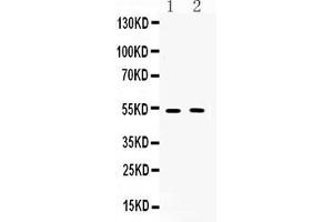 Western blot analysis of CHRM2 expression in rat brain extract ( Lane 1) and mouse brain extract ( Lane 2). (Muscarinic Acetylcholine Receptor M2 抗体  (C-Term))