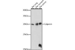 Western blot analysis of extracts of various cell lines, using Calponin antibody (ABIN7266040) at 1:1000 dilution. (CNN1 抗体  (AA 130-180))