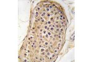 Formalin-fixed and paraffin-embedded human testis tissue reacted with RICTOR antibody (N-term) , which was peroxidase-conjugated to the secondary antibody, followed by DAB staining. (RICTOR 抗体  (N-Term))