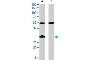 IGFBP3 polyclonal antibody  (0. (IGFBP3 抗体)