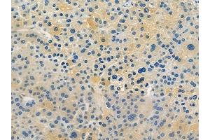 anti-Kinesin Family Member 1B (KIF1B) (pSer1487) antibody