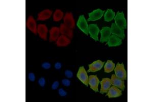 ABIN6263901 and ABIN6278065 staining Hela cells(30 min of UV treatment) by IF/ICC. (ORAI1 抗体  (C-Term))