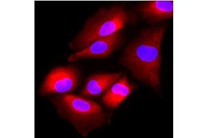 Immunofluorescence (IF) image for anti-N-Acetyltransferase 6 (GCN5-Related) (NAT6) (AA 1-308), (N-Term) antibody (ABIN452459) (NAT6 抗体  (N-Term))