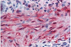 Human Colon, muscularis mucosa: Formalin-Fixed, Paraffin-Embedded (FFPE) (YAP1 抗体  (AA 53-162))