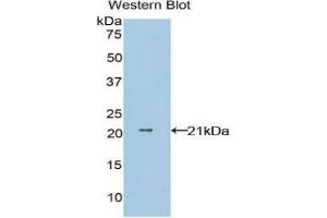 Western Blotting (WB) image for anti-Non-Metastatic Cells 1, Protein (NM23A) Expressed in (NME1) (AA 1-152) antibody (ABIN3202548) (NME1 抗体  (AA 1-152))