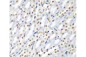 Immunohistochemistry of paraffin-embedded Mouse kidney using SF3B3 Polyclonal Antibody at dilution of 1:200 (40x lens). (SF3B3 抗体)