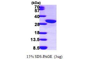 SDS-PAGE (SDS) image for Calbindin 2 (CALB2) (AA 1-271) protein (His tag) (ABIN667199) (Calretinin Protein (AA 1-271) (His tag))