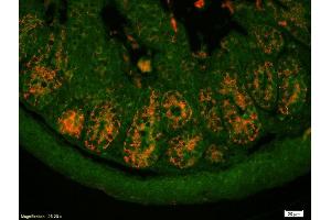 Formalin-fixed and paraffin-embedded mouse intestine labeled with Anti-PAI1/PLANH1/Serpine 1 Polyclonal Antibody, Unconjugated (ABIN718106) 1:200, overnight at 4°C, The secondary antibody was Goat Anti-Rabbit IgG, Cy3 conjugated used at 1:200 dilution for 40 minutes at 37°C. (PAI1 抗体  (AA 251-350))