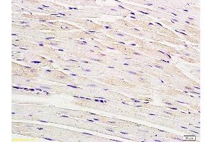 Formalin-fixed and paraffin embedded rat myocardium tissue labeled with Anti-Connexin-40 Polyclonal Antibody, Unconjugated  at 1:200, followed by conjugation to the secondary antibody and DAB staining (Cx40/GJA5 抗体  (AA 301-358))