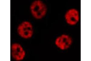 ABIN6267591 staining HeLa by IF/ICC. (MEF2A 抗体  (pThr319))