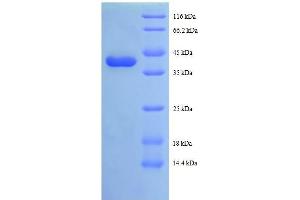 SDS-PAGE (SDS) image for Tax1 (Human T-Cell Leukemia Virus Type I) Binding Protein 3 (TAX1BP3) (AA 1-124), (full length) protein (GST tag) (ABIN1047723)