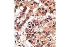 Image no. 2 for anti-Protein AF-9 (MLLT3) (C-Term) antibody (ABIN358673) (AF9 抗体  (C-Term))