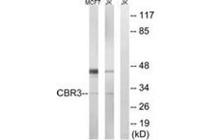 Western blot analysis of extracts from Jurkat/MCF7 cells, using CBR3 Antibody. (CBR3 抗体  (AA 151-200))