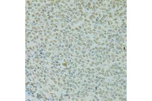 Immunohistochemistry of paraffin-embedded rat spleen using RCC1 antibody. (RCC1 抗体  (AA 1-240))