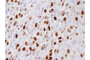 Immunohistochemistry (IHC) image for anti-Minichromosome Maintenance Complex Component 2 (MCM2) (pSer108) antibody (ABIN7448988)