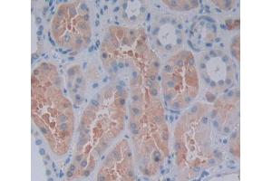 Used in DAB staining on fromalin fixed paraffin- embedded Kidney tissue (RIPK2 抗体  (AA 432-540))