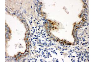 Immunohistochemistry (IHC) image for anti-Protein tyrosine Phosphatase Type IVA, Member 2 (PTP4A2) (AA 40-69), (N-Term) antibody (ABIN3043911)