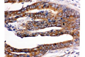 Immunohistochemistry (Paraffin-embedded Sections) (IHC (p)) image for anti-UPF1 Regulator of Nonsense Transcripts Homolog (UPF1) (AA 578-614), (Middle Region) antibody (ABIN3043955)