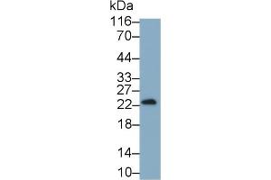 Detection of IFNg in Cavia Testis lysate using Monoclonal Antibody to Interferon Gamma (IFNg) (Interferon gamma 抗体  (AA 24-166))