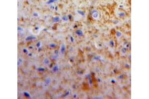 Used in DAB staining on fromalin fixed paraffin-embedded Brain tissue (Apelin 抗体  (AA 24-77))