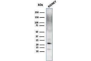 SDS-PAGE (SDS) image for anti-Ferritin, Light Polypeptide (FTL) (AA 38-165) antibody (ABIN6939461)