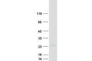 Transmembrane Protein 11 (TMEM11) (Transcript Variant 1) protein (Myc-DYKDDDDK Tag)
