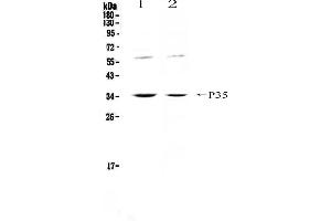 Western blot analysis of IL12A using anti-IL12A antibody . (IL12A 抗体  (AA 23-215))