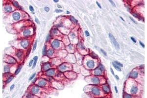 Immunohistochemistry staining of human prostate (paraffin sections) using anti-CD326 (VU-1D9). (EpCAM 抗体)