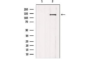 Western blot analysis of extracts from mouse brain, using CCP1 antibody. (AGTPBP1 抗体  (Internal Region))
