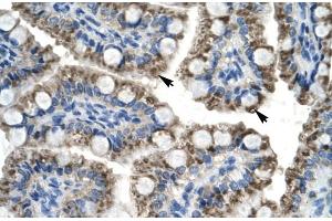 Rabbit Anti-C20orf100 Antibody Catalog Number: ARP30008 Paraffin Embedded Tissue: Human Intestine Cellular Data: Epithelial cells of intestinal villas Antibody Concentration: 4. (TOX2 抗体  (N-Term))